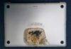 MacBook Pro 2015 model bursts into flames, user escapes with minor injuries MacBook Pro 2015 Fire