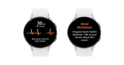 Samsung Galaxy Watches in India get potentially life-saving Irregular Heart Rhythm Notification feature