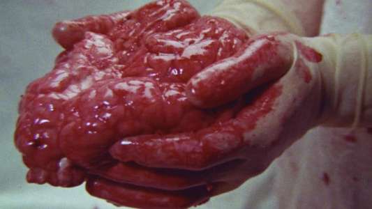 Brain of Blood - Backdrop