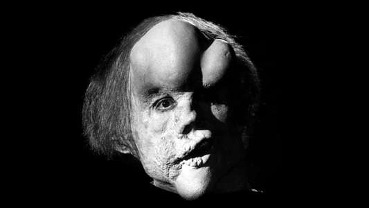 The Elephant Man - Backdrops