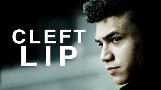 Cleft Lip - Backdrop