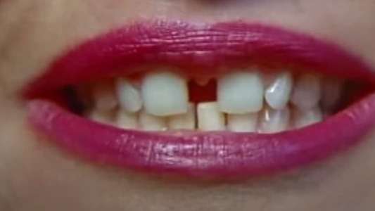 Gap-Toothed Women - Backdrop