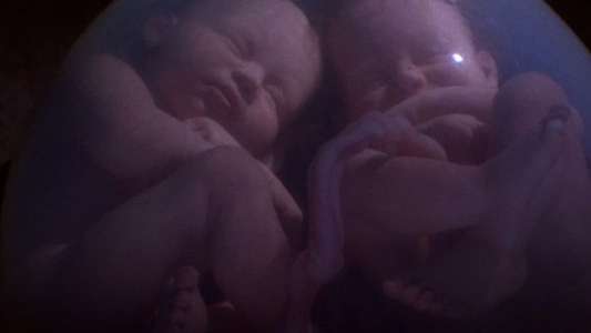 In the Womb: Multiples - Backdrop