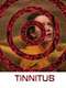 Tinnitus