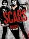 Scars