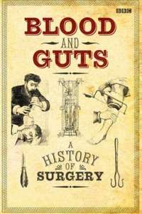 Blood and Guts: A History of Surgery - Poster