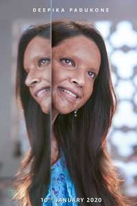 Chhapaak - Posters