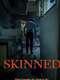 Skinned