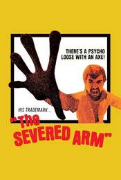 The Severed Arm