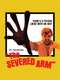 The Severed Arm