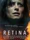 Retina