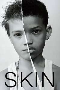 Skin - Poster