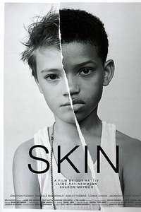 Skin - Poster