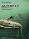 Autopsy