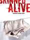 Skinned Alive