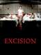 Excision