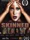 Skinned