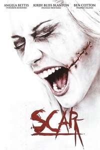 Scar - Posters
