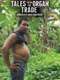 Tales from the Organ Trade
