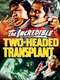 The Incredible 2-Headed Transplant