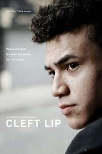 Cleft Lip - Poster