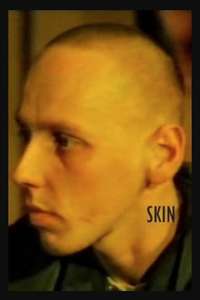 Skin - Poster