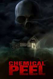 Chemical Peel