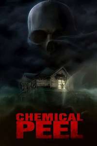 Chemical Peel - Poster