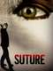 Suture
