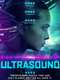 Ultrasound