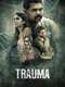 Trauma