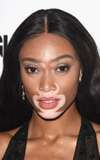 Winnie Harlow