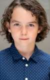 Calix Fraser